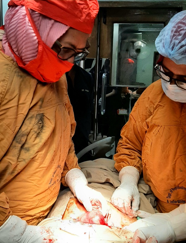 ADENOMYOMECTOMY OPERATION.....BY CHAIRMAN PROF. JESMINE BANU Madam